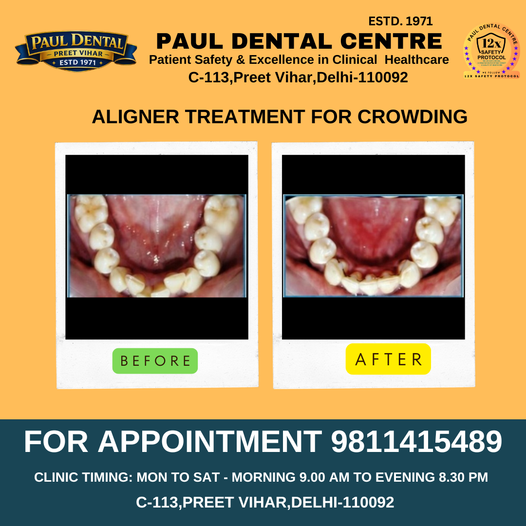 Case 22 – Paul Dental Center
